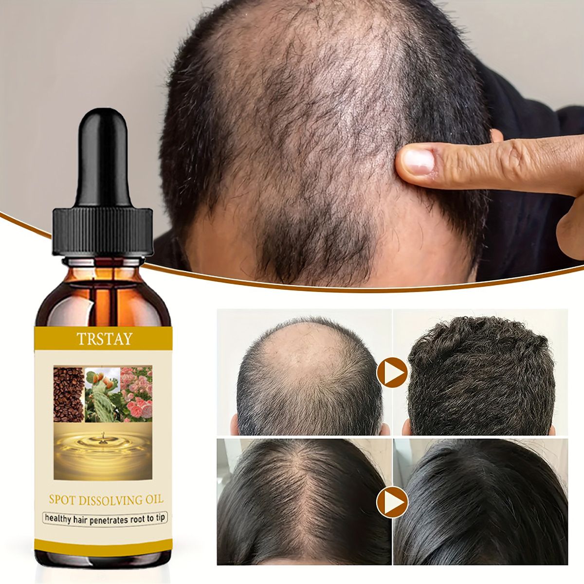50 ml Bartwachstumsöl, Anti-Al – Beard Oil Bewertung und Preis